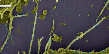 França investiga nova variante que escapa a teste PCR