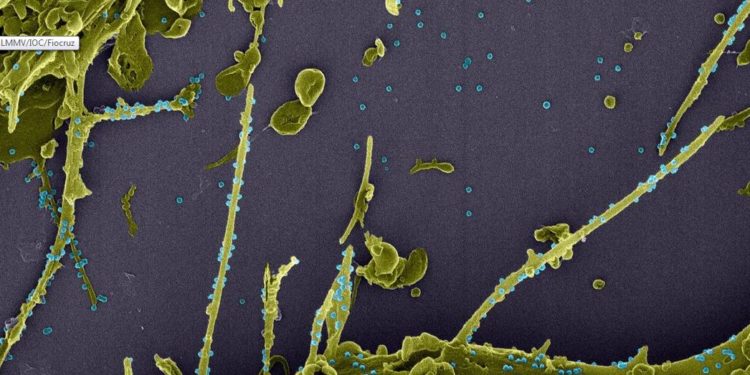 França investiga nova variante que escapa a teste PCR