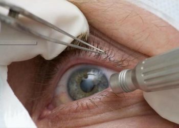Glaucoma: dado preocupante foi divulgado pela Sociedade Brasileira de Oftalmologia - Foto: Divulgação/Agência Brasil/ Pref. Tres Barras (SC)