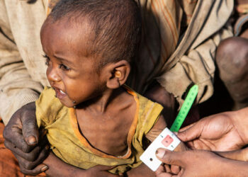 Crianças menores de cinco anos estão entre as mais afetadas pela desnutrição no Madagascar Foto: WFP/Tsiory Andriantsoarana