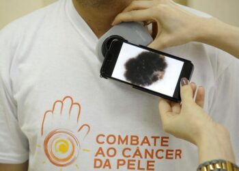 Dezembro Laranja é o mês de conscientização e prevenção contra o câncer de pele. Foto: Fernando Frazão/Agência Brasil