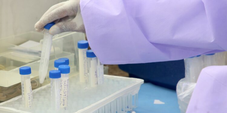 Falta de reagente suspende exames no Laboratório Municipal de Campinas