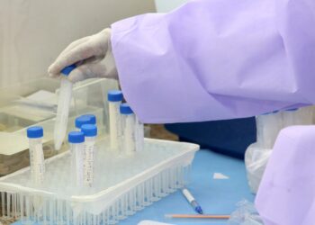 Falta de reagente suspende exames no Laboratório Municipal de Campinas