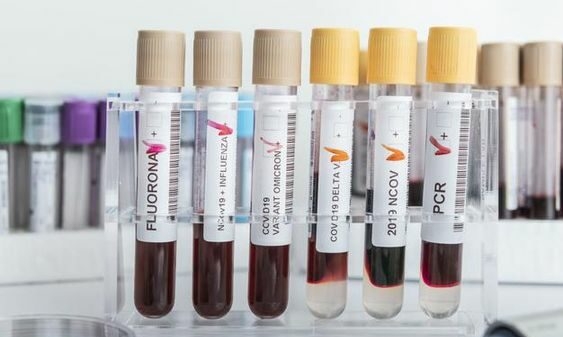 Campinas confirma primeiros casos da variante Ômicron