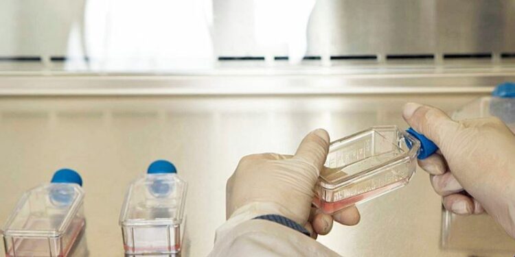 OMS: mais de 150 pessoas foram contaminadas com salmonela em chocolate