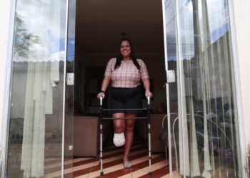 Talita: "Estamos na luta, minha tia abriu uma vaquinha virtual para a gente tentar chegar nesse valor para a prótese e fisioterapia" Foto: Leandro Ferreira/Hora Campinas