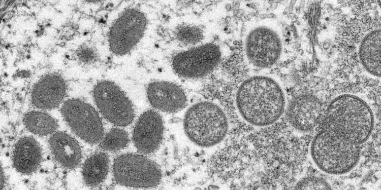 A varíola dos macacos é uma doença causada por vírus. Foto: Divulgação