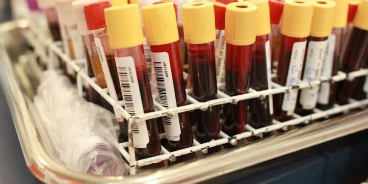 Médicos debatem em live a importância de quebrar tabus e elevar o número de doadores de sangue - Foto: Leandro Ferreira/Hora Campinas
