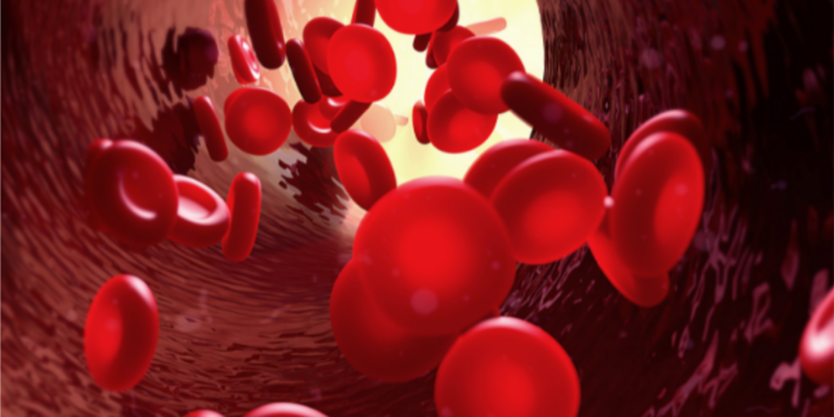 SBTH e Unicamp iniciam projeto inédito de registros de trombose venosa no Brasil