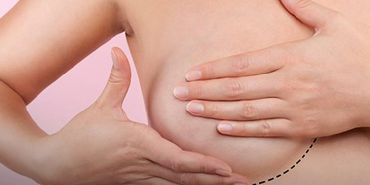 Estudo analisou dados de rastreamento mamográfico, avaliando a capacidade do SUS de atender a população alvo dos exames - Foto: Divulgação/Sociedade Brasileira de Mastologia