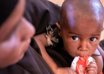 Criança se alimenta de um sachê de comida terapêutica na Somália. ONU pede ação urgente para salvar vidas em países atingidos por crise alimentar - Foto: Unicef