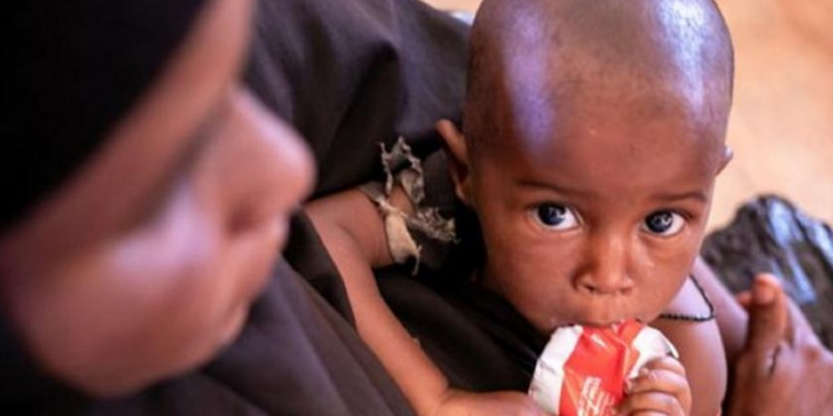 Criança se alimenta de um sachê de comida terapêutica na Somália. ONU pede ação urgente para salvar vidas em países atingidos por crise alimentar - Foto: Unicef