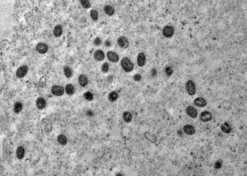 A varíola dos macacos é transmitida pelo vírus monkeypox, que pertence ao gênero orthopoxvirus Foto: Débora Barreto-Vieira/IOC/Fiocruz