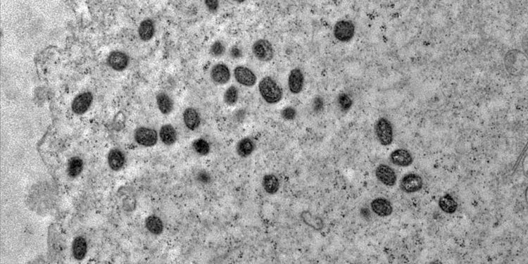 A varíola dos macacos é transmitida pelo vírus monkeypox, que pertence ao gênero orthopoxvirus Foto: Débora Barreto-Vieira/IOC/Fiocruz