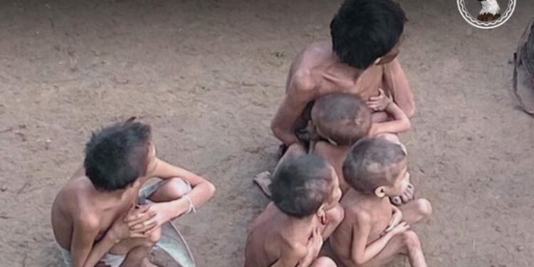 Imagens de crianças e adultos esqualidos e doentes percorreram o Brasil e o mundo, revelando o drama Yanomami - Foto: Instagram/Urihi Associação Yanomami