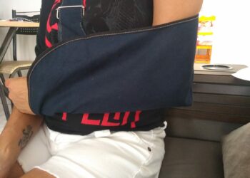 Gislaine está com o braço imobilizado após sofrer trauma no cotovelo esquerdo Foto: Hora Campinas