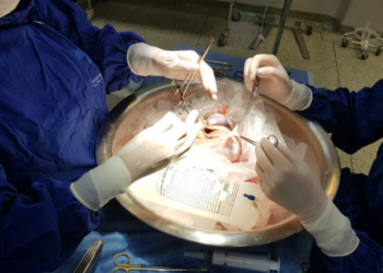 Cirurgiões preparam fígado captado para realizam de transplante - Foto: HC da Unicamp