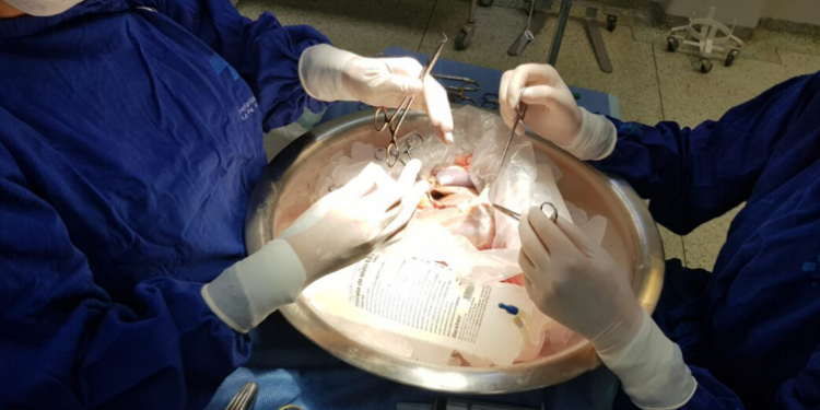 Cirurgiões preparam fígado captado para realizam de transplante - Foto: HC da Unicamp