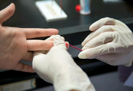 Saúde de Campinas faz teste rápido de sífilis neste sábado