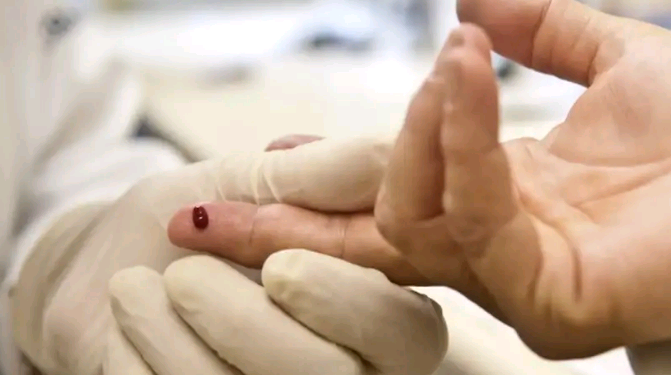 Casos de sífilis e de HIV/aids aumentam entre homens jovens