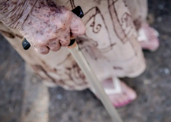 Ortopedistas alertam para risco de queda de idosos; saiba como evitar