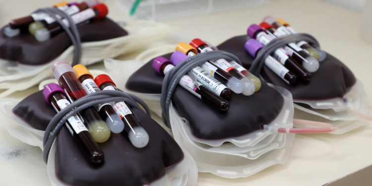 GM organiza Campanha Sangue Azul para reforçar estoques do Hemocentro