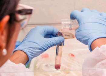 Atendimento a pacientes com colesterol alto cresce 41% no SUS de SP