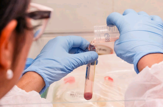 Atendimento a pacientes com colesterol alto cresce 41% no SUS de SP