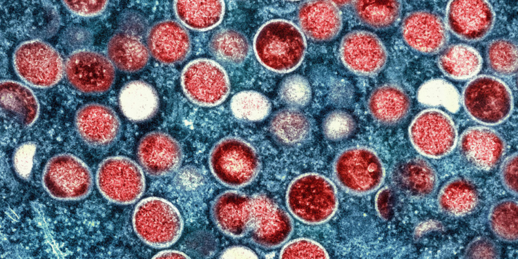 Mpox volta a ser emergência de saúde pública de preocupação internacional