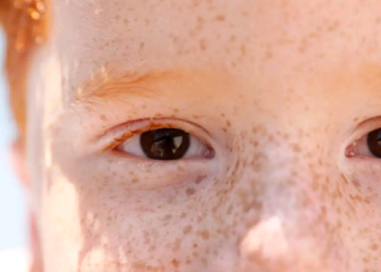 Campanha de conscientização sobre retinoblastoma começa neste sábado