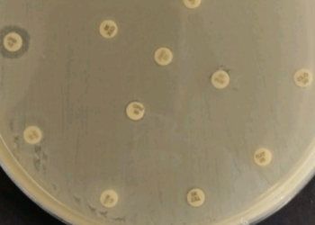 Fapesp: bactéria multirresistente que representa risco global de saúde é detectada no Nordeste