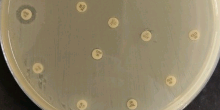 Fapesp: bactéria multirresistente que representa risco global de saúde é detectada no Nordeste