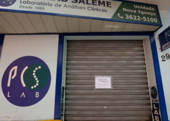 Mulher é presa por envolvimento em caso de HIV em transplante no Rio