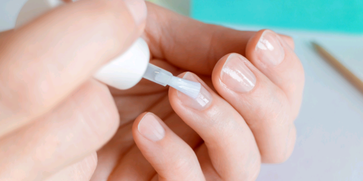 Unhas quebradiças? Síndrome das unhas frágeis atinge 2 a cada 10 brasileiros