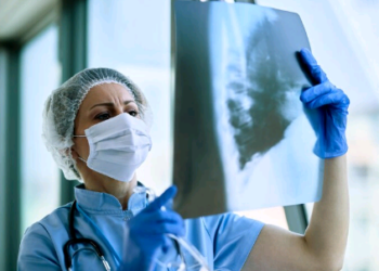 Tuberculose: a praga que se recusa a ir embora – por Carmino de Souza