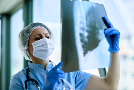 Tuberculose: a praga que se recusa a ir embora – por Carmino de Souza