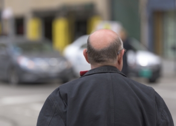 Câncer de pele no couro cabeludo: conheça os cuidados para se proteger