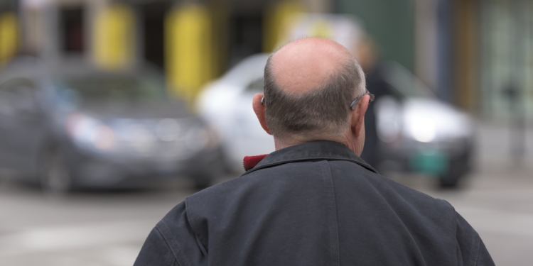 Câncer de pele no couro cabeludo: conheça os cuidados para se proteger