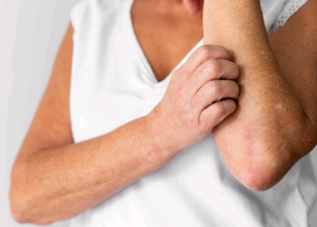 Diagnóstico tardio aumenta chances de contágio pela hanseníase