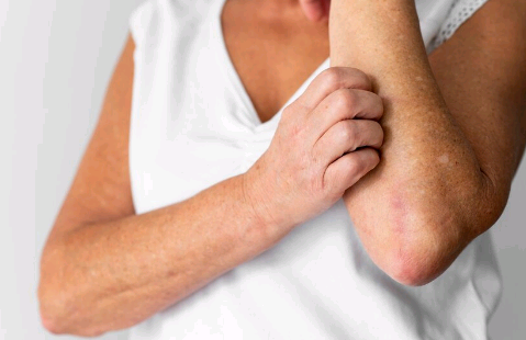 Diagnóstico tardio aumenta chances de contágio pela hanseníase