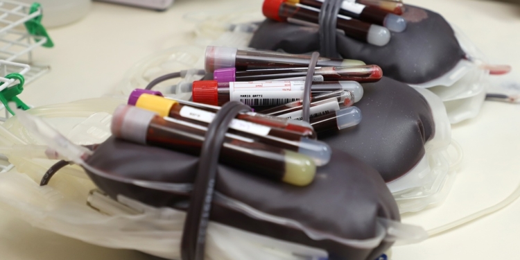 Doe sangue e ajude o Hemocentro a repor os estoques