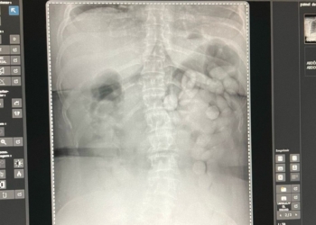 Sete flagrantes de tráfico de drogas foram registrados neste ano em Viracopos