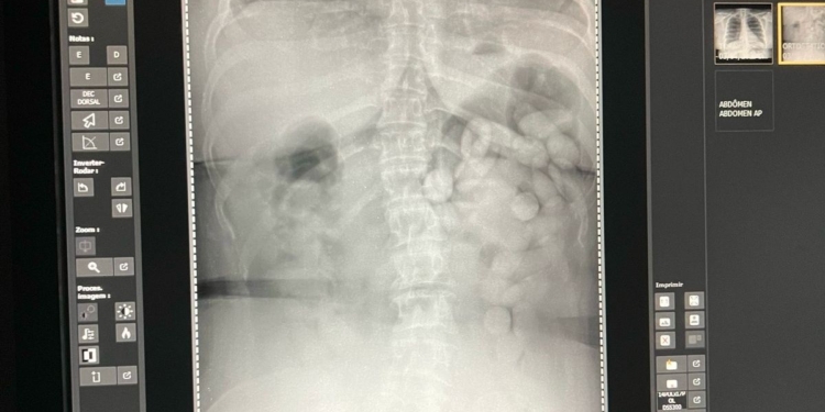 Sete flagrantes de tráfico de drogas foram registrados neste ano em Viracopos