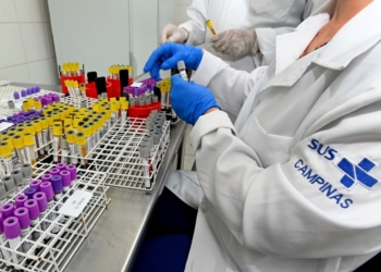 Capacidade do Laboratório Municipal será ampliada em 1 milhão de exames