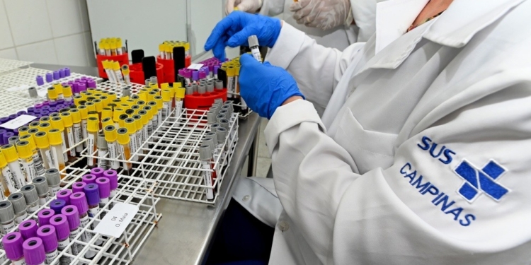 Capacidade do Laboratório Municipal será ampliada em 1 milhão de exames