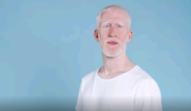 Governo sanciona lei que cria política de proteção a pessoas com albinismo