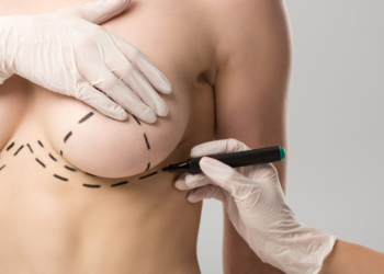 Milhares de mulheres aguardam na fila pela reconstrução de mamas