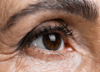 As principais doenças e os cuidados na higiene dos olhos e pálpebras