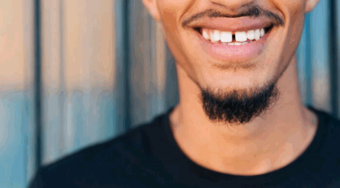 Você tem tido motivos para sorrir? – por Thiago Pontes