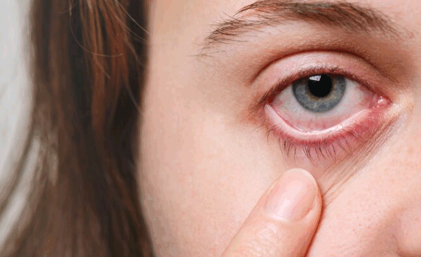 Telas aumentam olho seco entre jovens, diz pesquisa